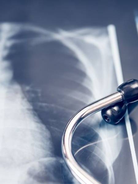 Choroby płuc: Objawy, przyczyny i możliwości leczenia